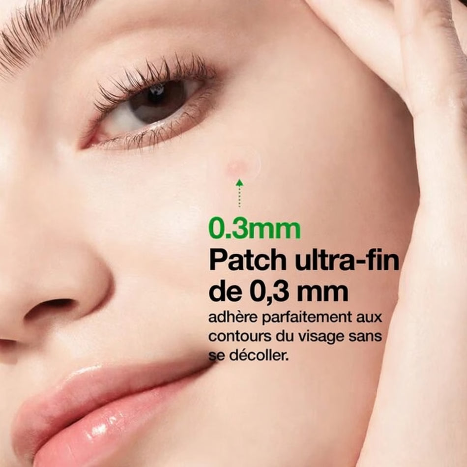 ANUA Patch Microdart Anti-Boutons Triple Acide (AHA+BHA+PHA) – 12 patchs