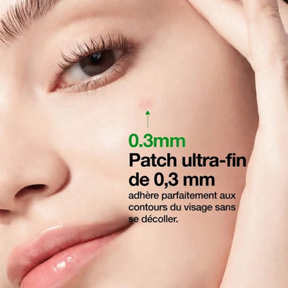 ANUA Patch Microdart Anti-Boutons Triple Acide (AHA+BHA+PHA) – 12 patchs