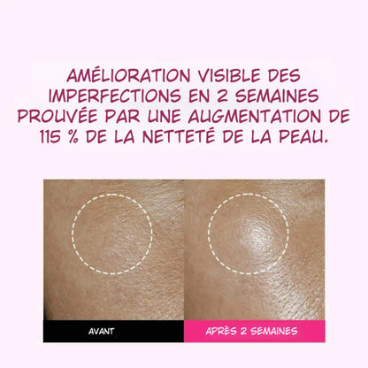 ISOI Blemish Care Up Serum - Sérum Anti-Taches à la Rose Bulgare - 35ml